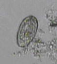 微生物（グラウコマ）の写真
