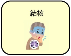 結核