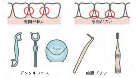 デンタルフロスや歯間ブラシ