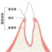 正常な歯と歯肉の状態