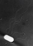 腸管出血性大腸菌o157の画像