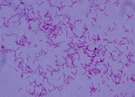 レジオネラ属菌の画像