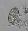 微生物（グラウコマ）の写真